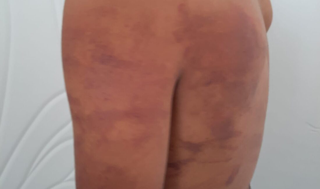 Şanlıurfa’nın Suruç ilçesinde iddiaya göre babası ve amcası tarafından ahırda
