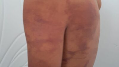 Şanlıurfa’nın Suruç ilçesinde iddiaya göre babası ve amcası tarafından ahırda