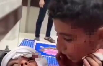 Gazze’de Filistinli bir çocuk, İsrail’in hastaneye düzenlediği saldırıda yaralanan kardeşine