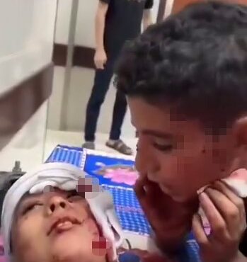 Gazze’de Filistinli bir çocuk, İsrail’in hastaneye düzenlediği saldırıda yaralanan kardeşine