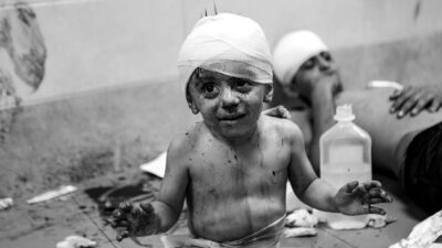 Gazze’deki Filistin Sağlık Bakanlığı: İsrail’in Gazze Şeridi’ne saldırılarında 1524’ü çocuk,