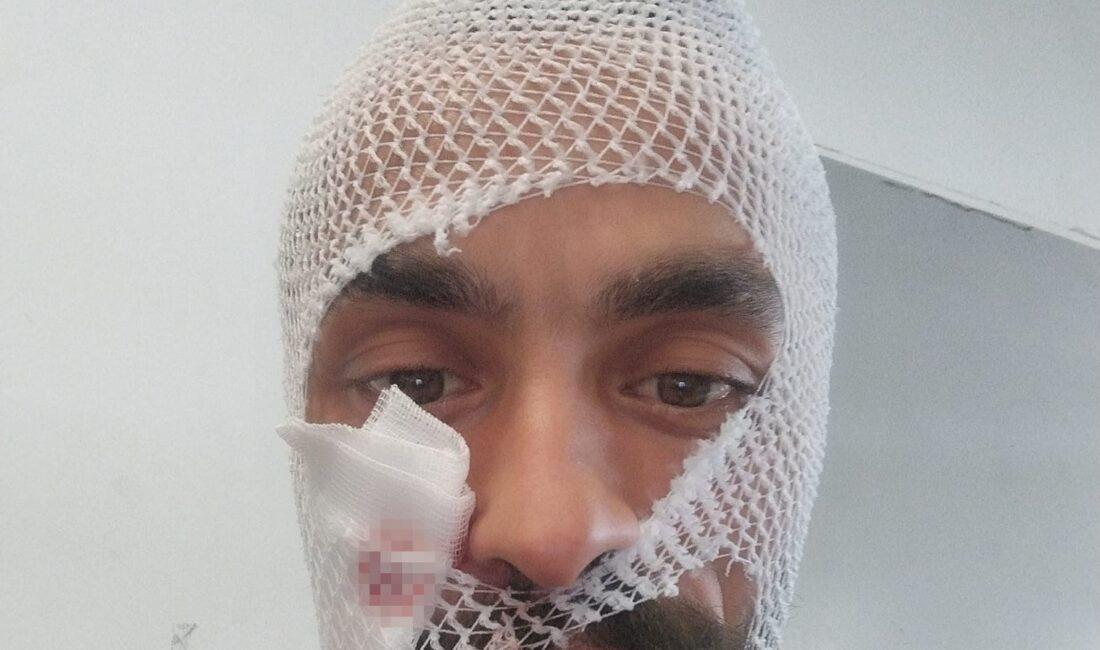 Çorum’da hayvancılık ile uğraşan genç, bakımını yaptığı ineğin boynuz darbesi