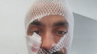 Çorum’da hayvancılık ile uğraşan genç, bakımını yaptığı ineğin boynuz darbesi