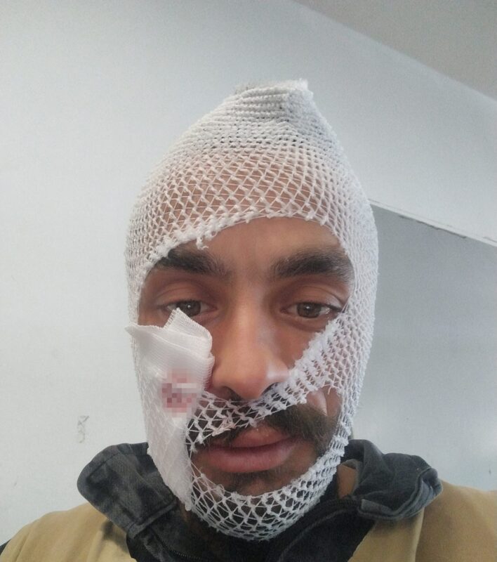 Çorum’da hayvancılık ile uğraşan genç, bakımını yaptığı ineğin boynuz darbesi