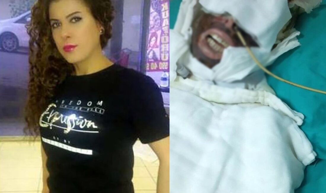 Avcılar’da saplantılı şekilde aşık olduğu Yasemin Uzunçelebi’nin başından aşağı kimyasal