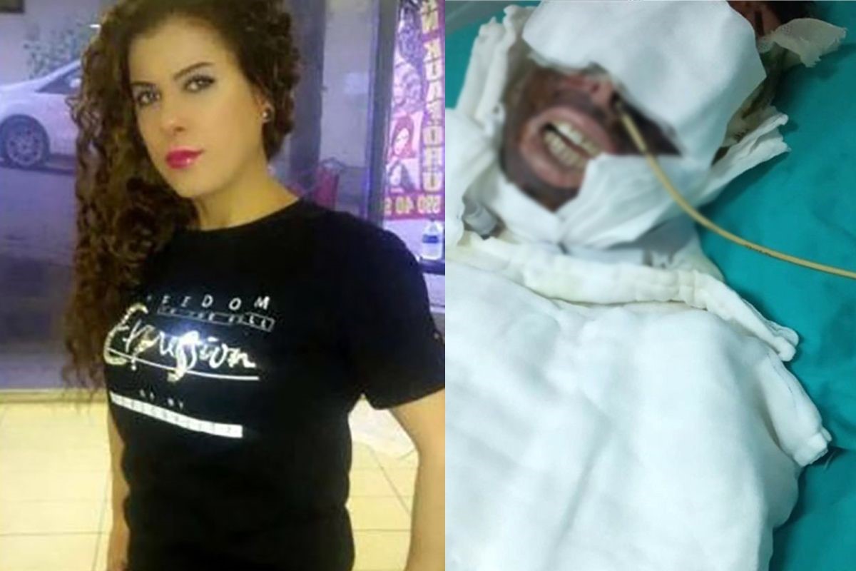 Avcılar’da saplantılı şekilde aşık olduğu Yasemin Uzunçelebi’nin başından aşağı kimyasal