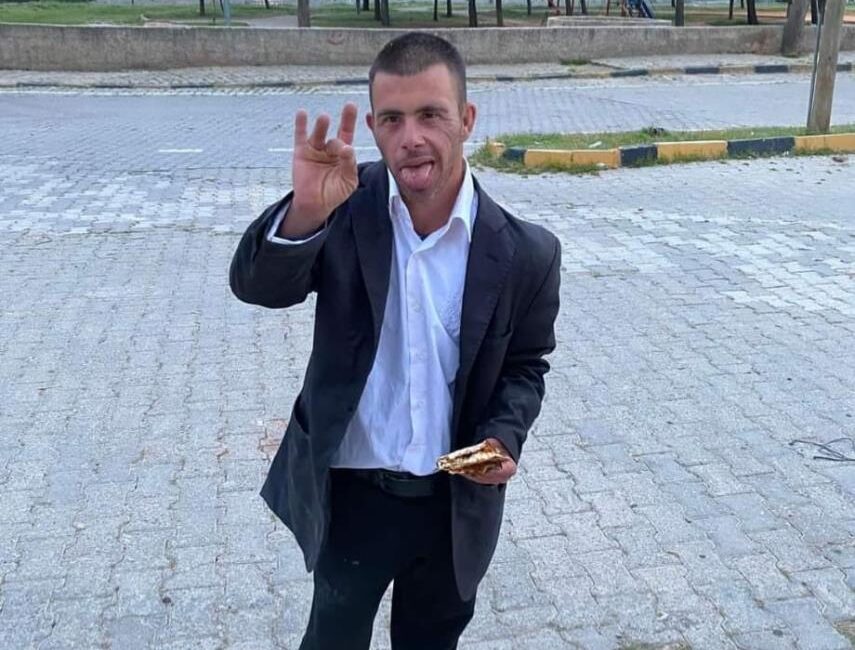 Gaziantep’in Nizip ilçesinde kamyonetin çarptığı 38 yaşındaki down sendromlu Mustafa