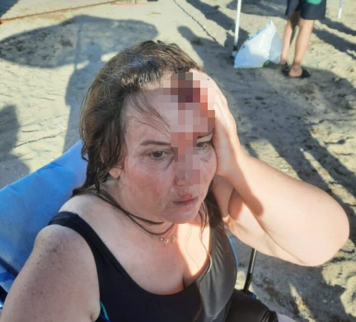 Kocaeli’nin Darıca ilçesinde denizde yüzerken jet skinin çarpması sonucu yaralanan