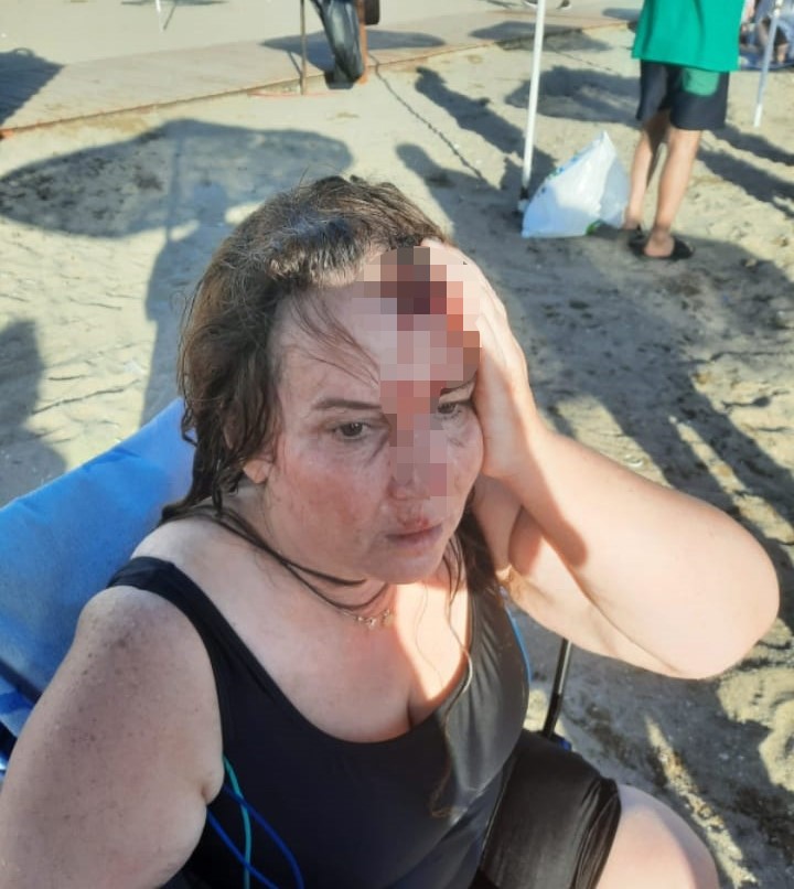 Kocaeli’nin Darıca ilçesinde denizde yüzerken jet skinin çarpması sonucu yaralanan