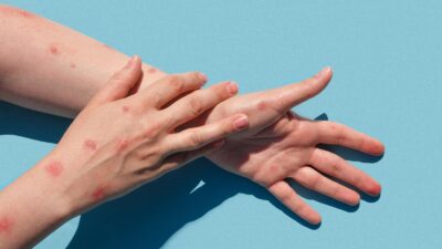   Yakın Doğu Üniversitesi, Dünya Sağlık Örgütü’nün “küresel acil durum”