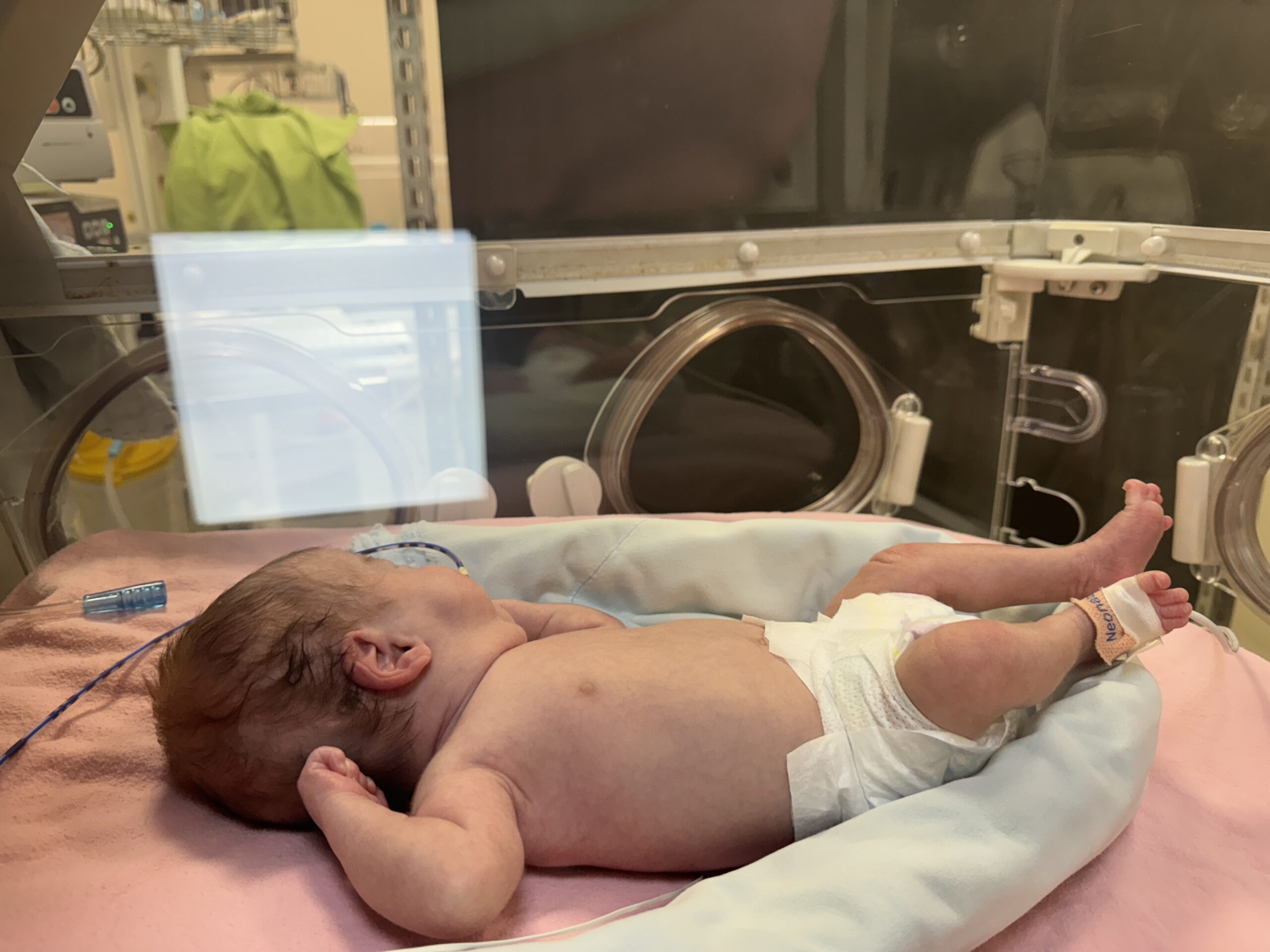 Afyonkarahisar’da 24 haftalıkken 760 gram ağırlığında dünyaya gelen Ebrar Çetinkaya,