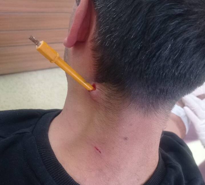Esenyurt’ta iki komşu arasında çıkan park yeri kavgasında, evinin önüne