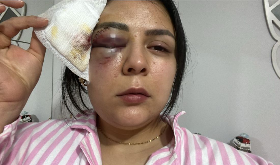 
Kahramanmaraş'ın Pazarcık ilçesinde yaşayan 23 yaşındaki Nisa Akdere, 16 Ocak