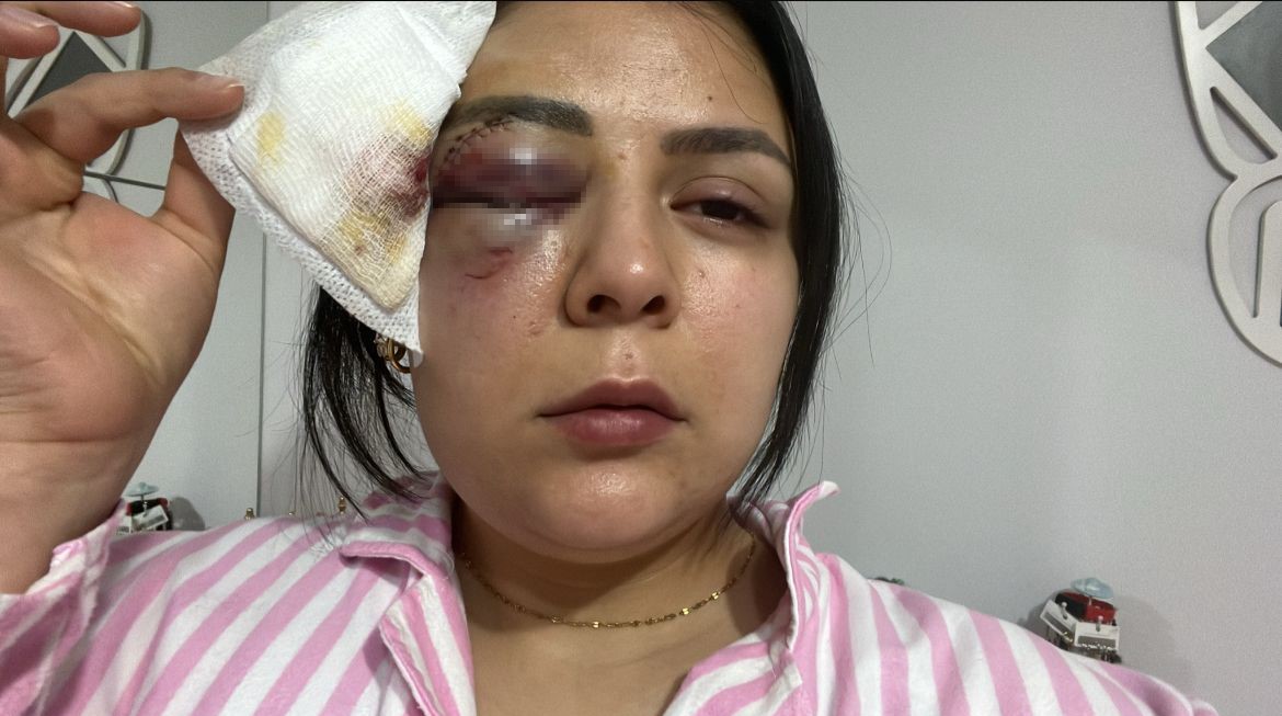 
Kahramanmaraş'ın Pazarcık ilçesinde yaşayan 23 yaşındaki Nisa Akdere, 16 Ocak