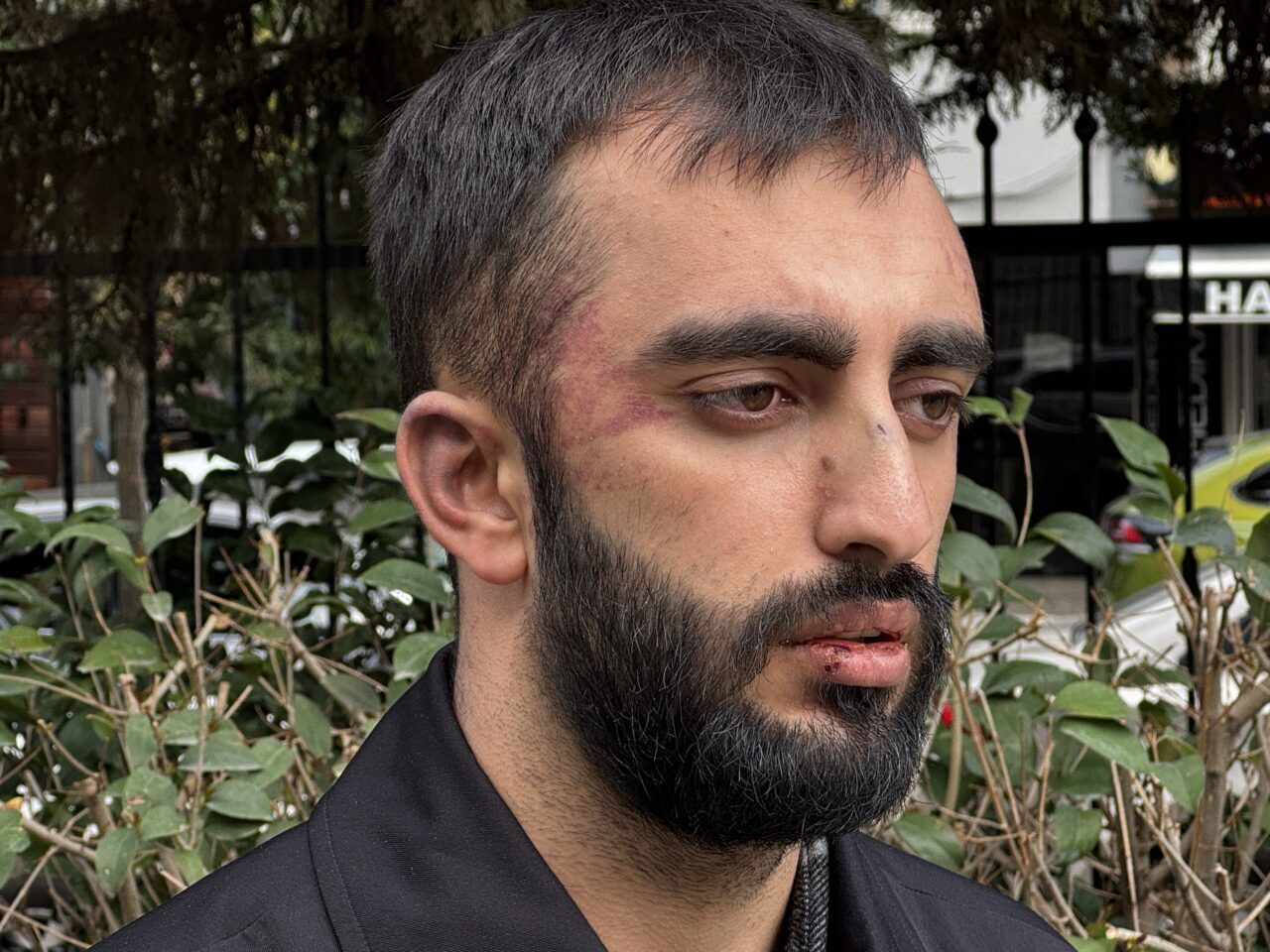 İzmir’in Buca ilçesinde, kendisine saldıran köpeklerden kaçıp bir iş yerine