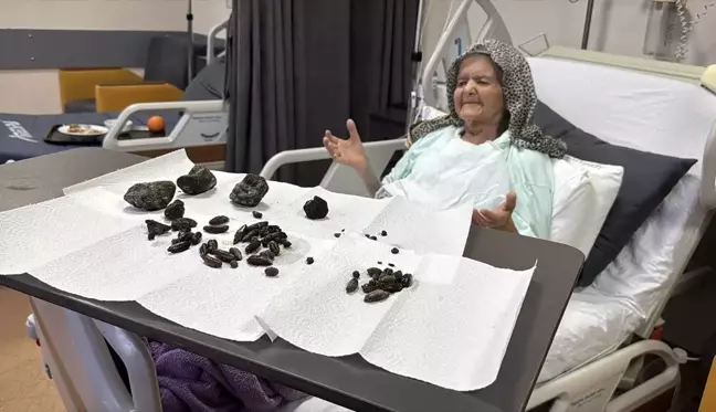 Zonguldak'ta midesinden ve bağırsağından ameliyatla 28 hurma ve 35 zeytin