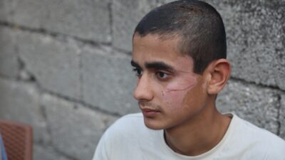  Hatay'da 6 kişinin öldüğü kazadan yaralı olarak kurtulan 17 yaşındaki