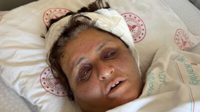  İzmir'in Bayındır ilçesinde yufka yüzünden tartıştığı gelininin tuğlayla dövüp komalık