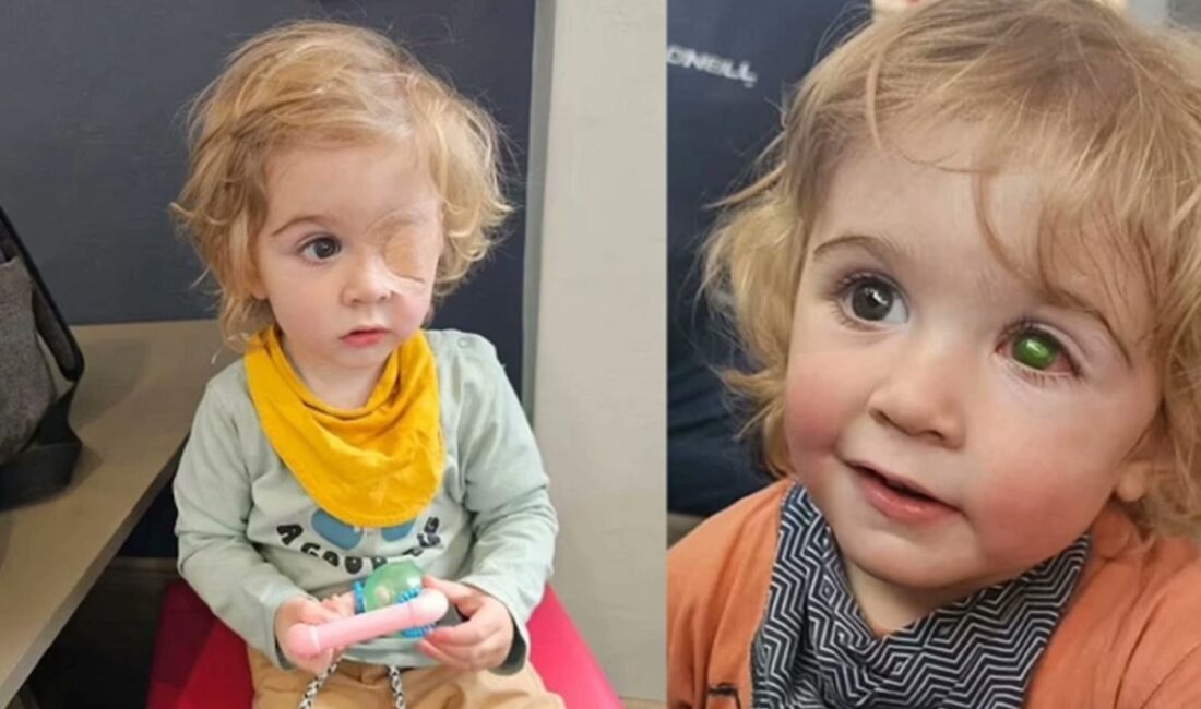 İngiltere’de 2 yaşındaki bir çocuk, bir yakını tarafından öpüldükten sonra