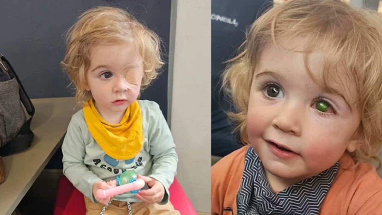 İngiltere’de 2 yaşındaki bir çocuk, bir yakını tarafından öpüldükten sonra