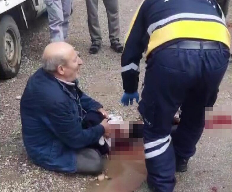 Antalya’da meydana gelen trafik kazası sonrası çıkan kavgada motosiklet sürücüsü