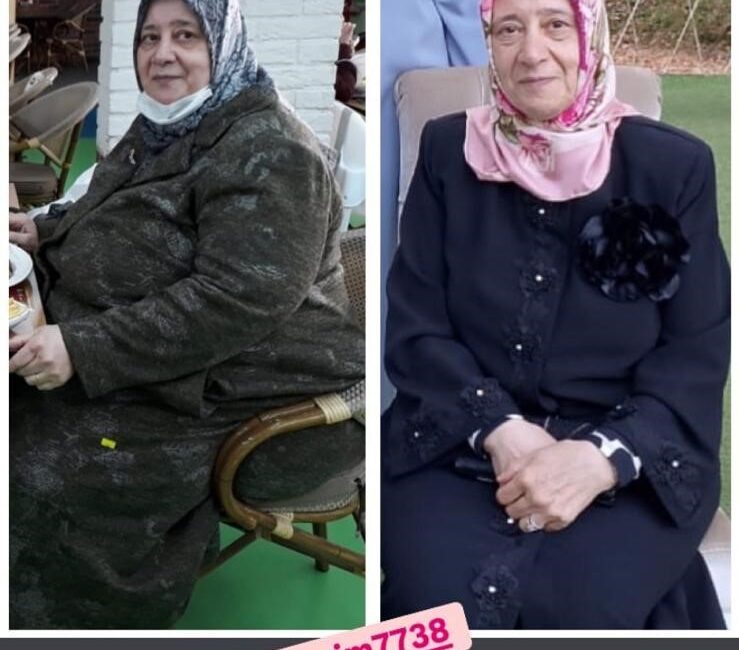 Bursa'da ilerlemiş yaşına rağmen yaptığı diyetle 22 ayda 128 kilodan