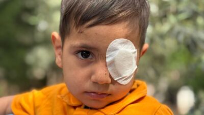 Aydın'ın Söke ilçesinde sahipsiz köpeğin saldırısı sonucu gözünden yaralanan 3