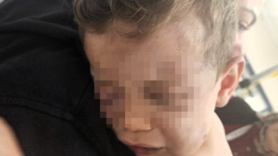 Denizli'de annesinin erkek arkadaşı tarafından dövüldüğü iddia edilen 2 yaşındaki