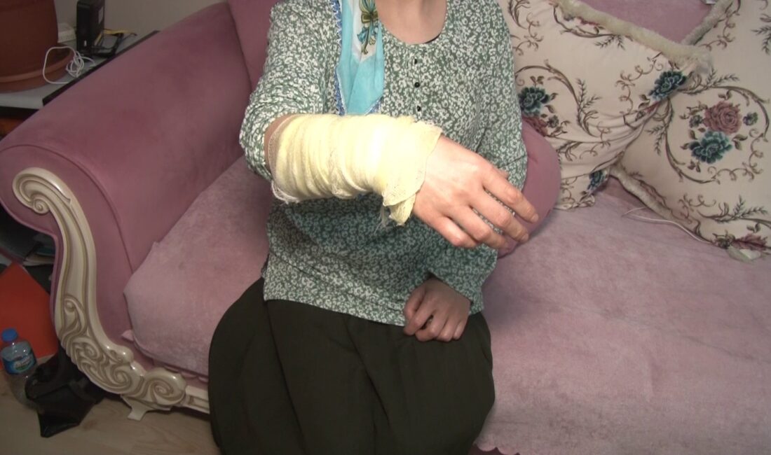 Esenyurt’ta öfkeli koca, boşanmak isteyen eşinin evine kezzapla saldırdı. Kayınpeder