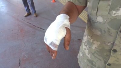 Şanlıurfa’da Kurban Bayramı’nın ilk gününde kurban kesimi sırasında kendini yaralayan