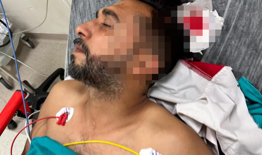 Adana'da bir döner ustası iş yerinde çalıştığı sırada başına isabet
