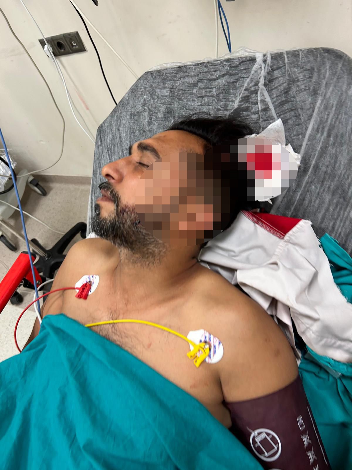 Adana'da bir döner ustası iş yerinde çalıştığı sırada başına isabet