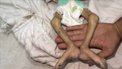 İsrail ordusunun şiddetli saldırılarının yanı sıra insani yardım girişini kısıtlayarak