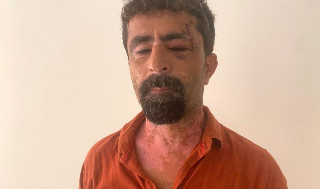Antalya'nın Serik ilçesinde, evi terk ederek babasının yanına sığınan eşinin
