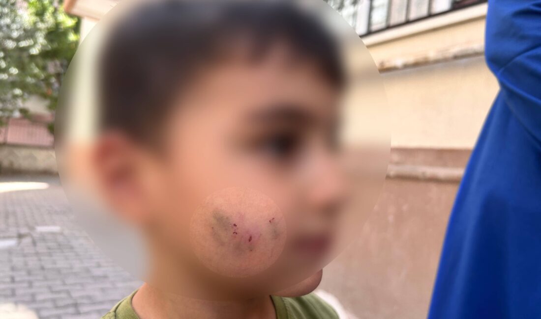 Ankara'nın Sincan ilçesinde, evinde uyumakta olan bir çocuk lağım faresi