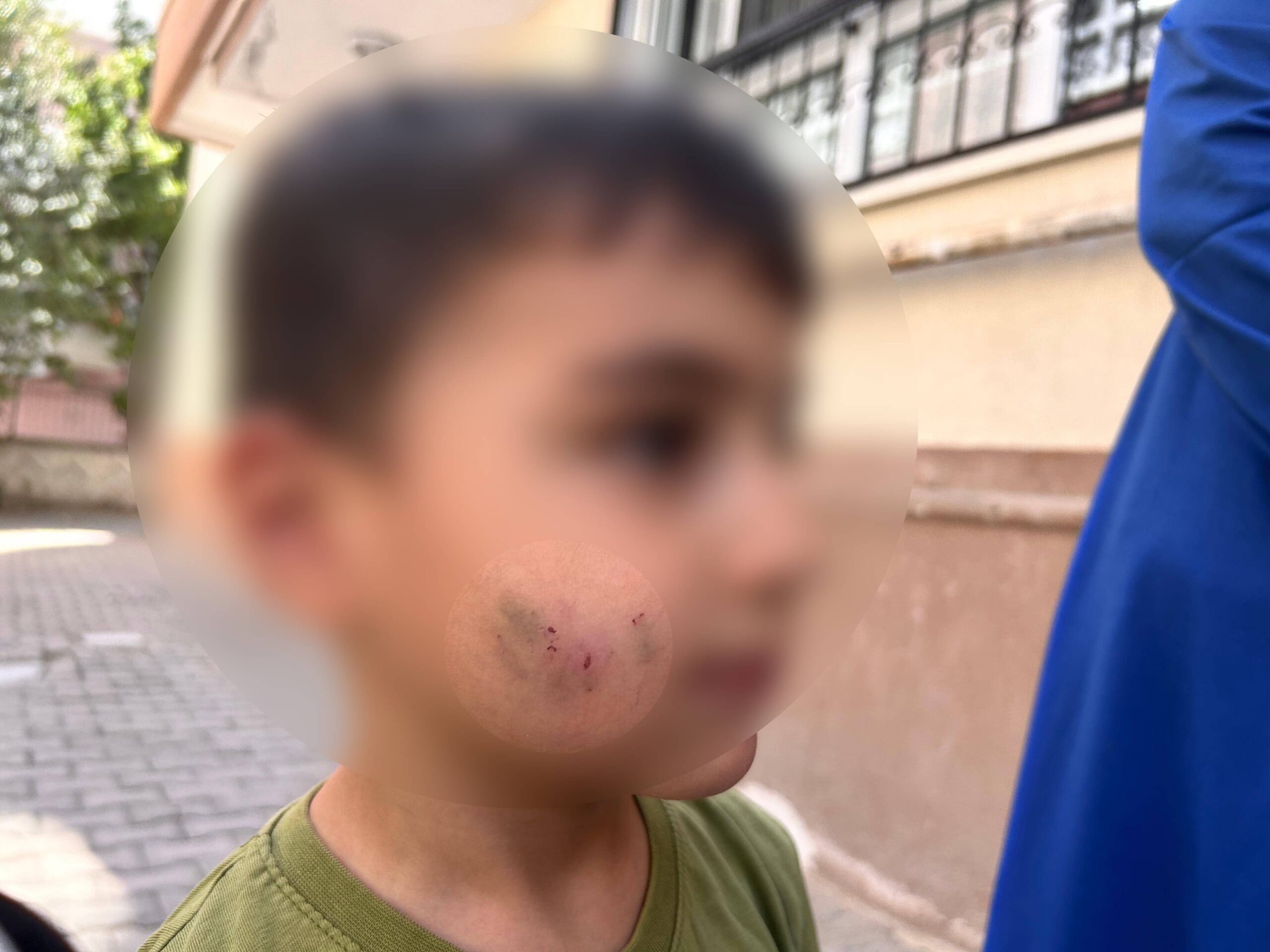 Ankara'nın Sincan ilçesinde, evinde uyumakta olan bir çocuk lağım faresi