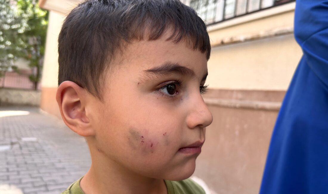 Ankara Sincan Fevzi Çakmak Mahallesi’nde evde uyuyan 13 yaşındaki çocuk,