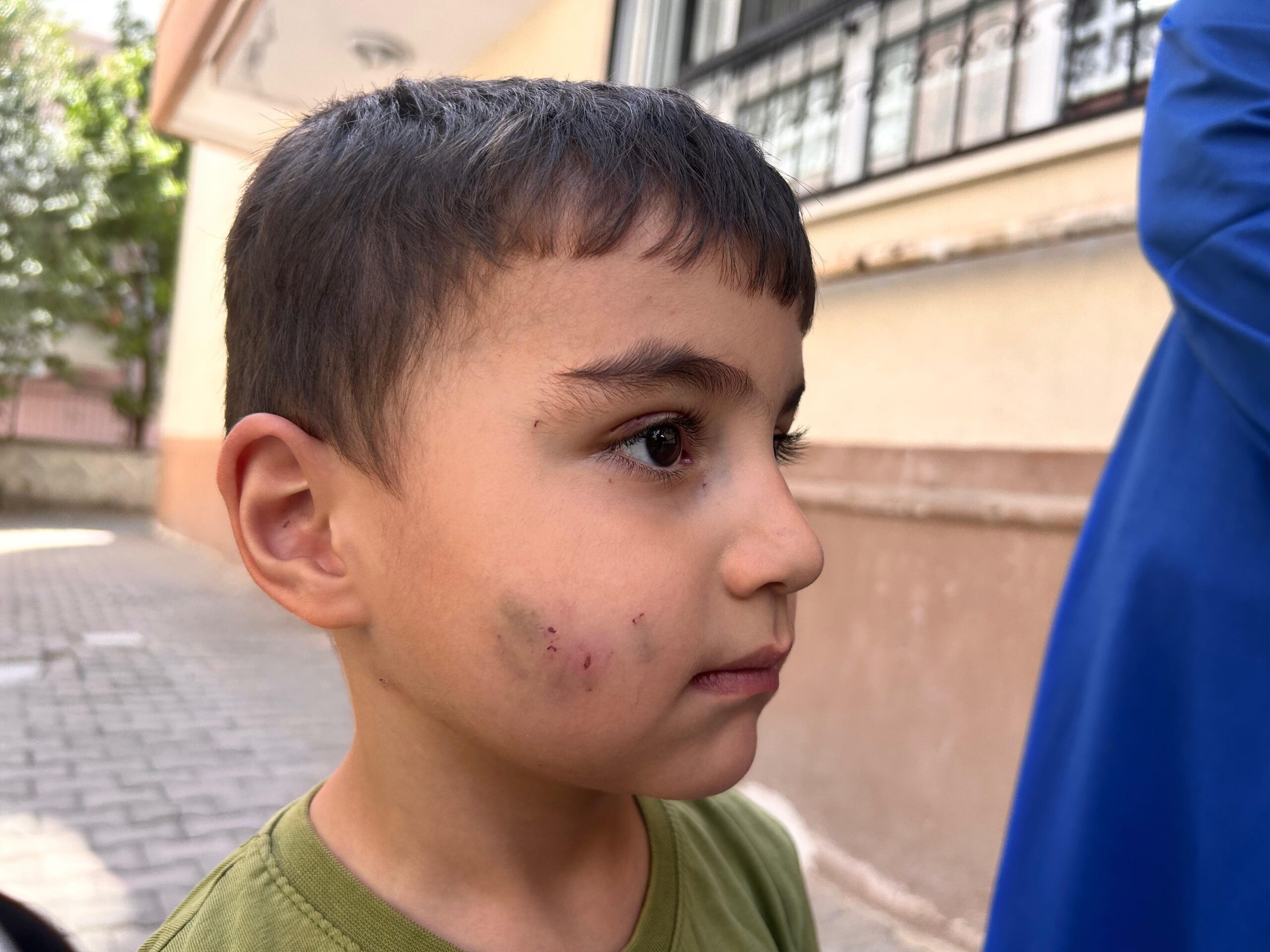 Ankara Sincan Fevzi Çakmak Mahallesi’nde evde uyuyan 13 yaşındaki çocuk,