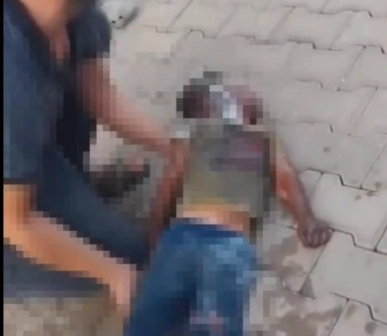 Kahramanmaraş'ın Türkoğlu ilçesinde bir konteynerde çıkan yangında ağır yaralanan 3