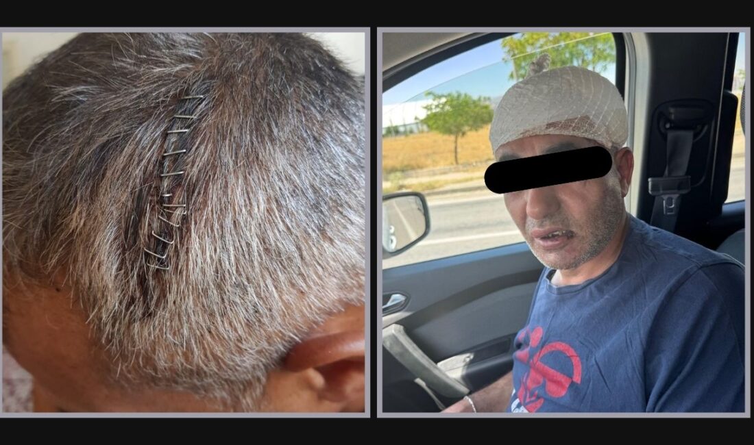 Afyonkarahisar’da gittiği eğlence merkezi çıkışında görevliler tarafından darp edildiğini iddia