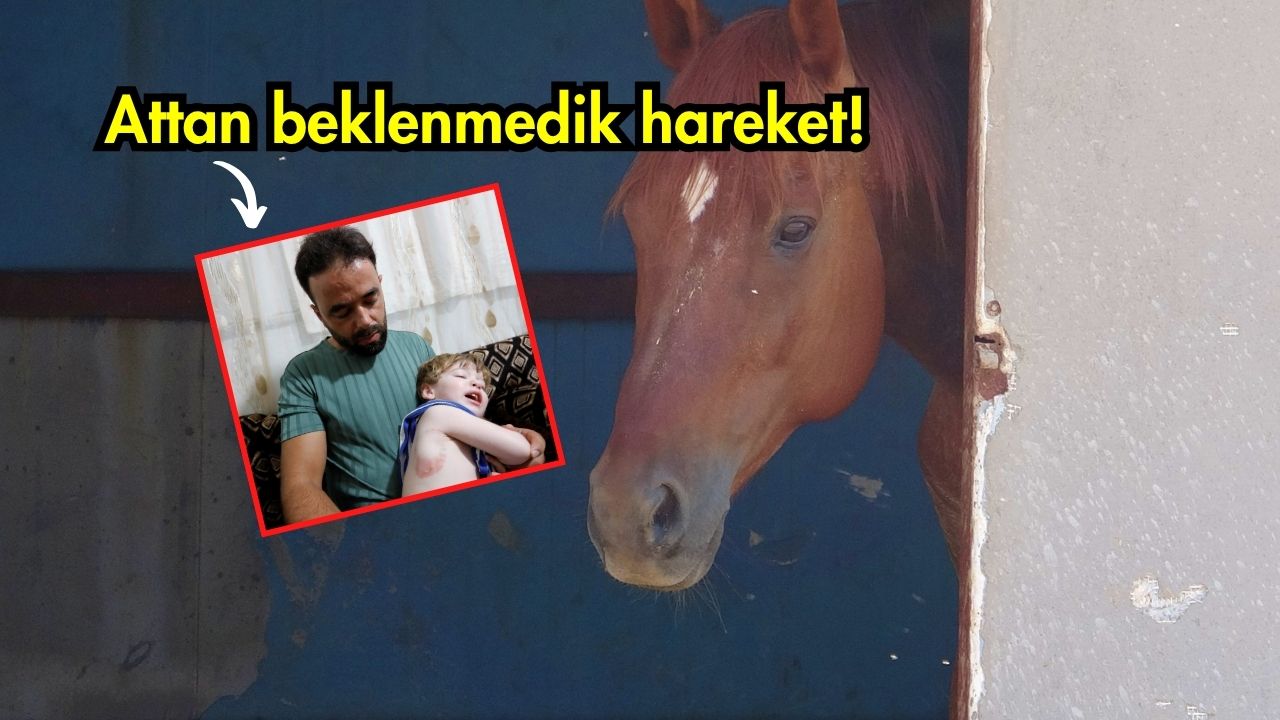  Antalya'da yolda görerek sevmek istediği atın beklenmedik bir şekilde ısırarak