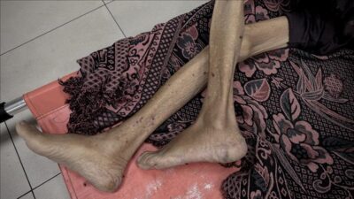 İsrail ablukası ve saldırıları altındaki Gazze Şeridi'nde insani durum endişe