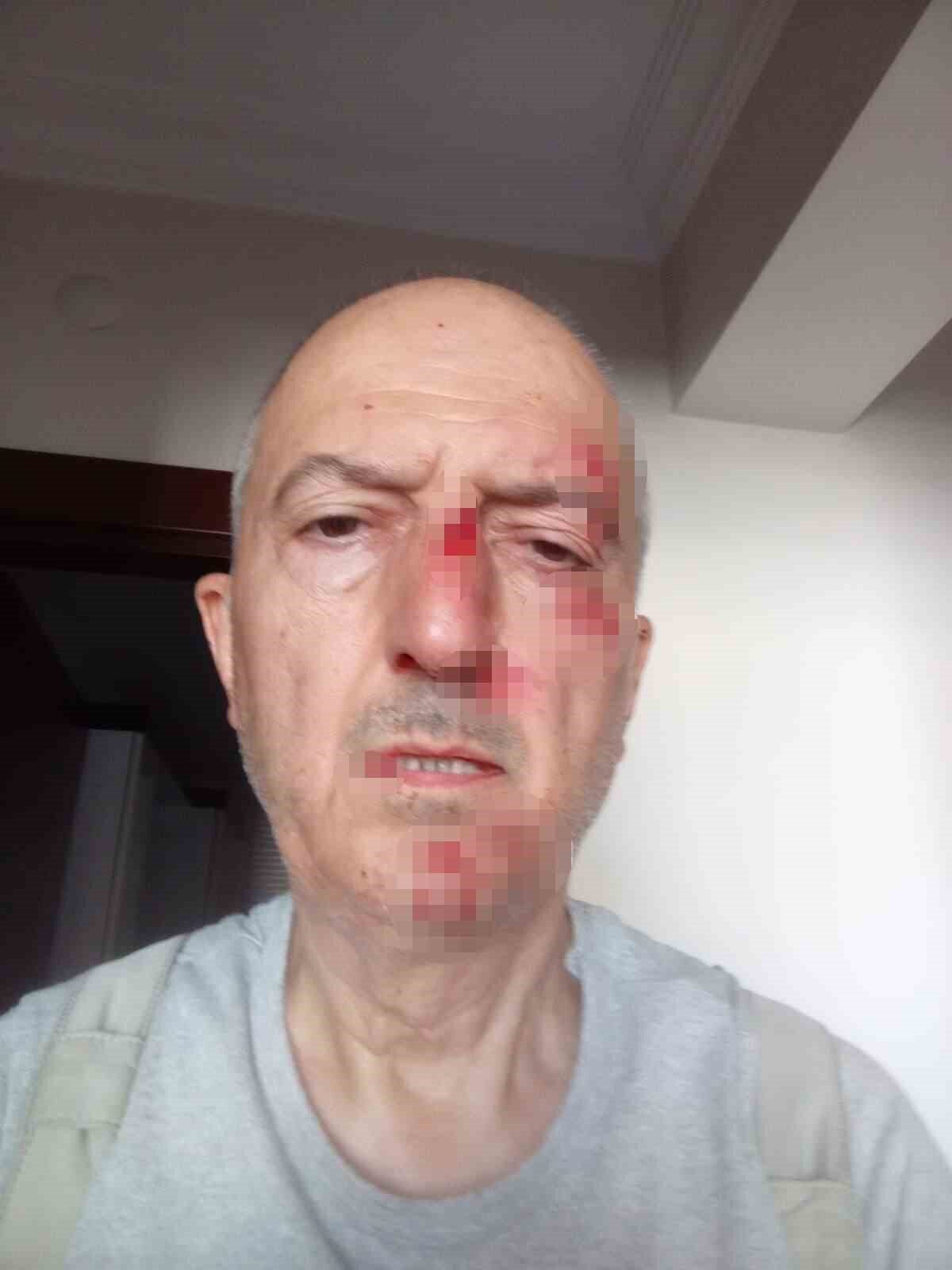 Afyonkarahisar’da bir şahıs, boşanma aşamasındaki karısının oturdukları evi satmasının ardından