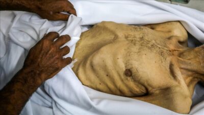 İsrail’in kıtlığı dayattığı Gazze Şeridi’nde son 24 saatte 7 Filistinli