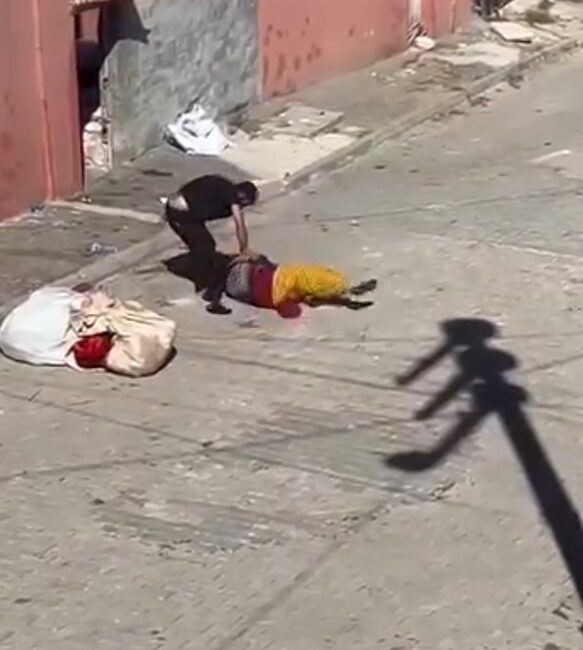 Eskişehir’de sokak ortasında eşi tarafından darp edilen Fatma Hüseyin, şaşırtıcı