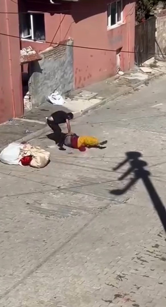 Eskişehir’de sokak ortasında eşi tarafından darp edilen Fatma Hüseyin, şaşırtıcı