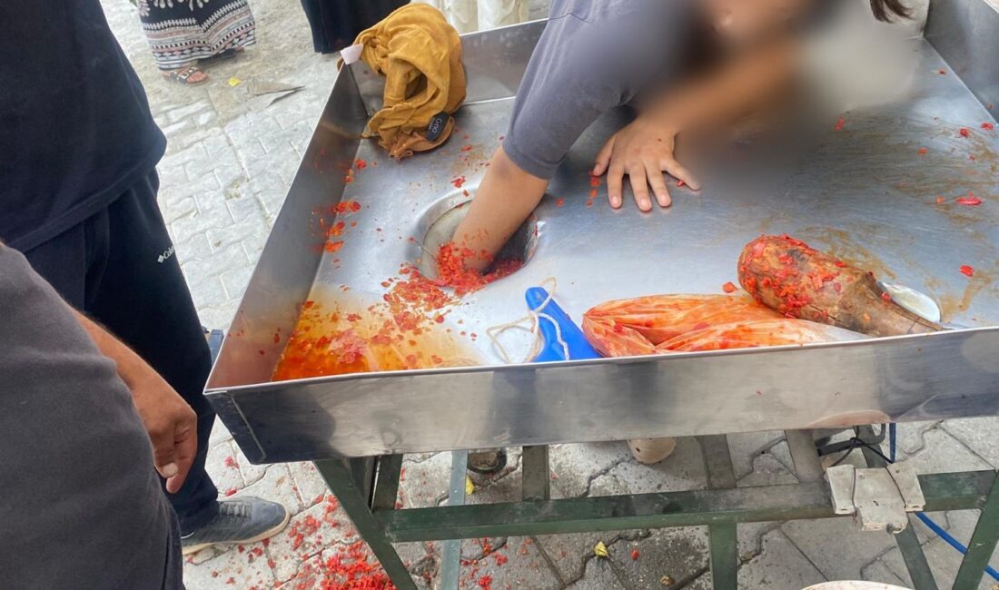 Salça Yaparken Feci Kaza: Genç Kız Elini Makineye Kaptırdı Salça hazırlığı sırasında elini makineye kaptıran 16 yaşındaki genç kız,