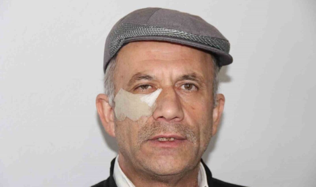Eskişehir’de komşusu tarafından darp edilen Adem Rıfat Demirkoparan, yaşadıklarını anlatırken,
