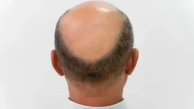 Tayvan Ulusal Üniversitesi’nden bilim insanları, yalnızca 20 gün içinde saç