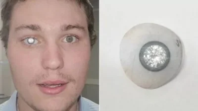 ABD'nin Alabama eyaletinde kuyumcu Slater Jones, görme yetisini kaybettiği sağ